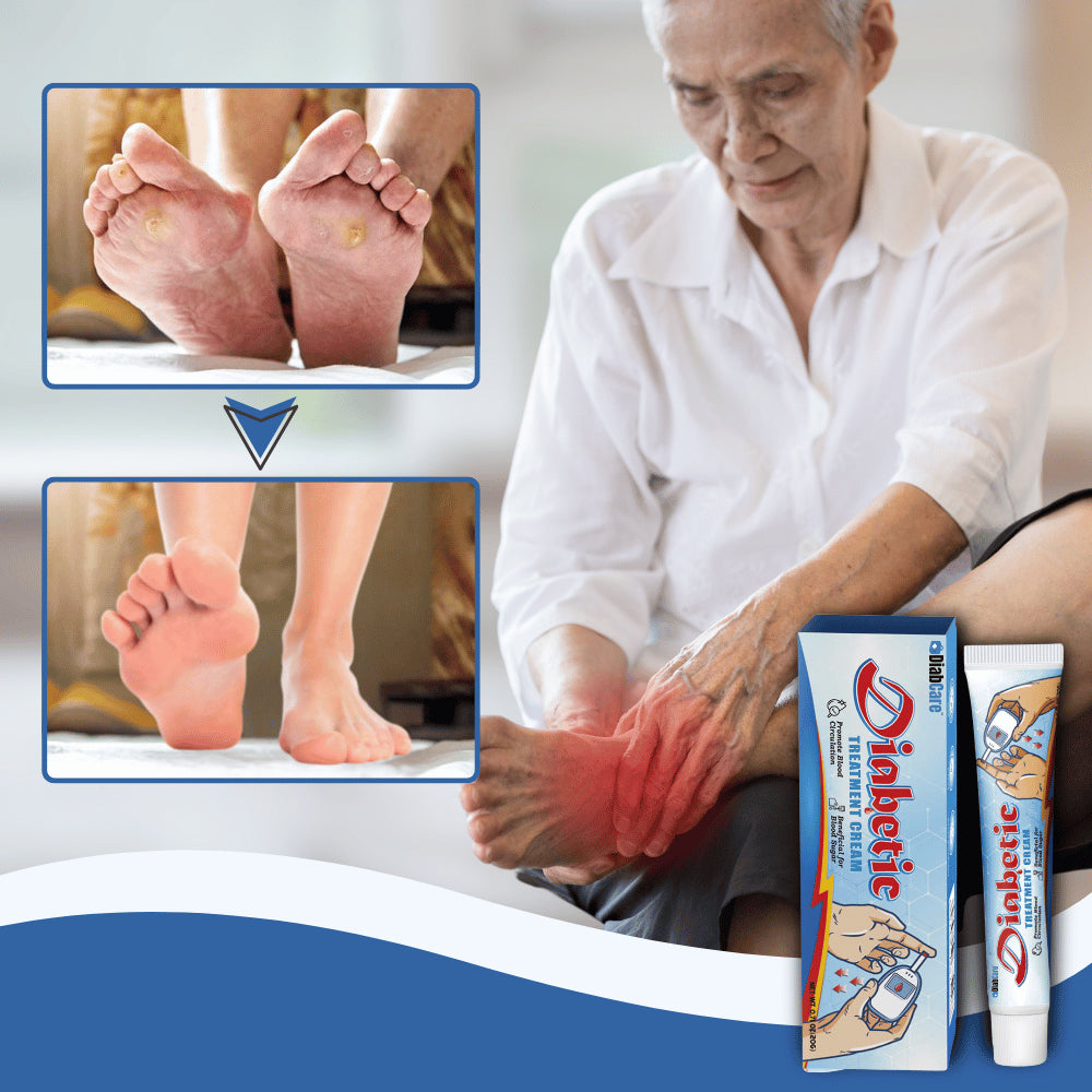 DiabCare™ Diabetinis gydomasis kremas | Jokio skausmo dėl diabetinių žaizdų iš karto!
