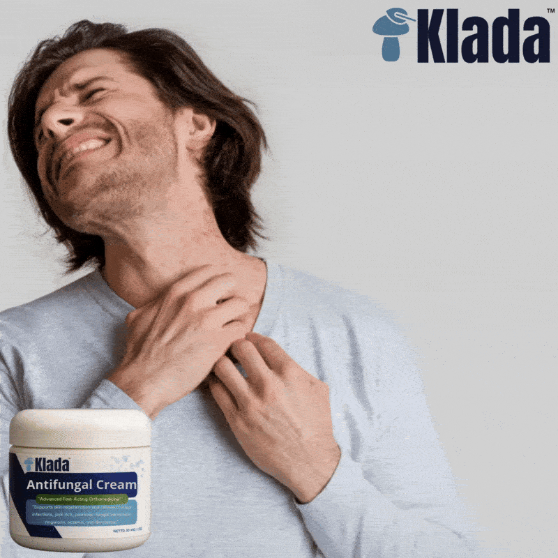 Klada™ egzemos kremas | Sumažinkite 89 % visų egzemos simptomų vos per 7 dienas!