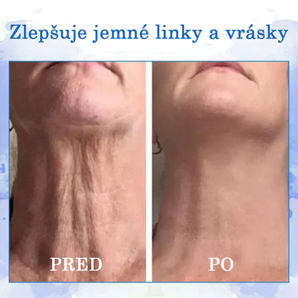 Fubsta® Advanced Kremas Suglebusiai Odai