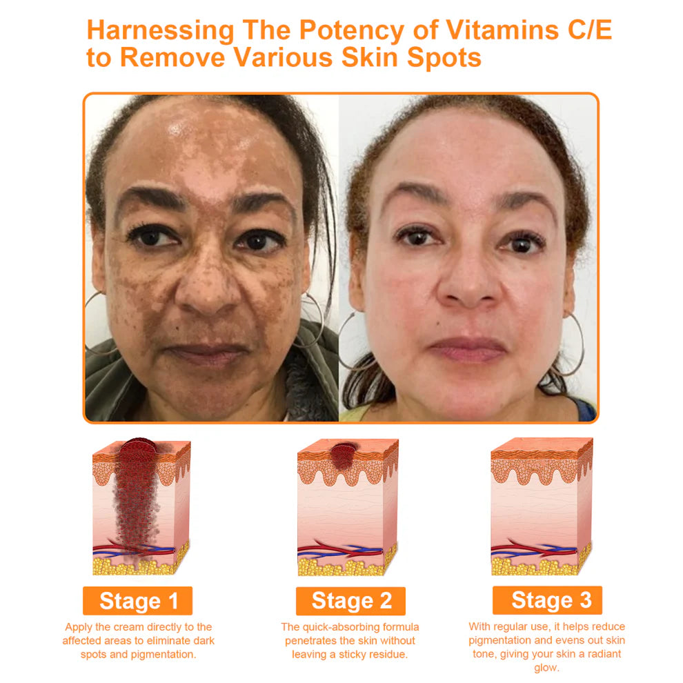 𝗧𝗟𝗢𝗣𝗔™ Galingas viso kūno odos priežiūros kremas (rekomenduojama AAD)