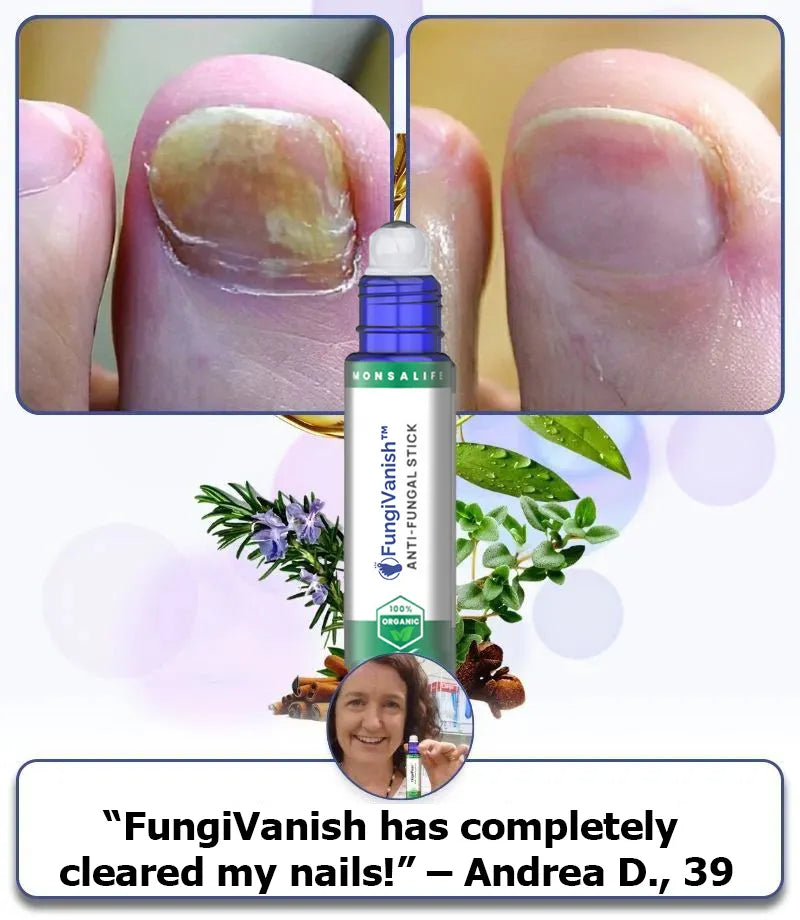 FungiVanish™ | Atsikratykite įsisenėjusio nagų grybelio vos per 7 dienas!