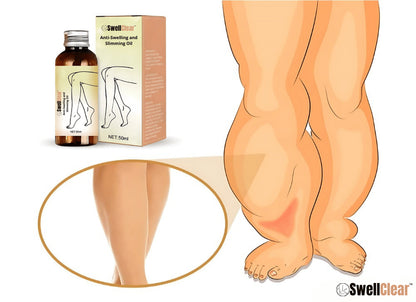 SwellClear™ aliejus nuo patinimų ir lieknėjimo | Atsisveikinkite su užsispyrusiu patinimu vos per 7 dienas!