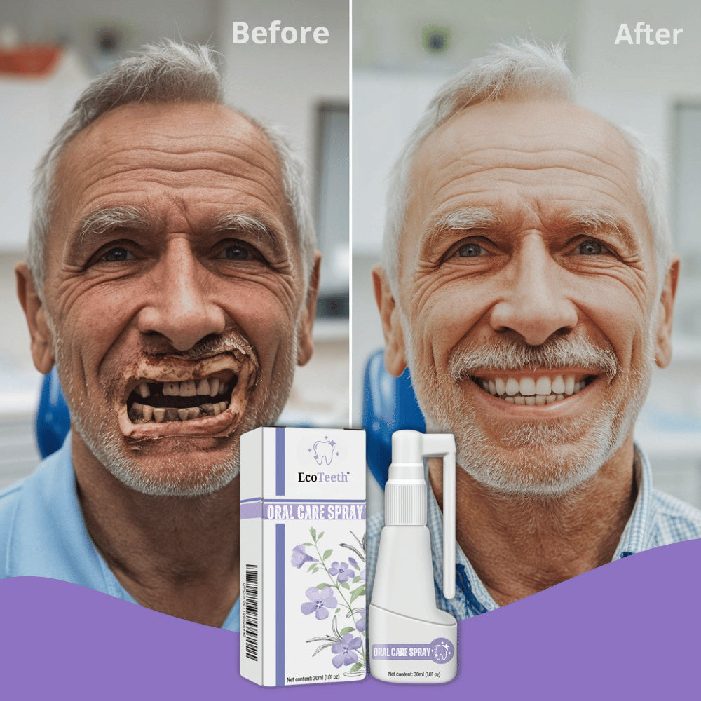 „EcoTeeth™“ burnos priežiūros purškalas | Gingivito ir skausmo malšinimas per 7 dienas!