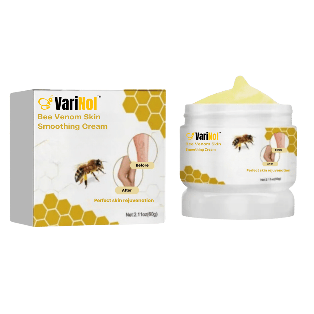 „VariNol™“ kremas nuo venų varikozės | Atsikratykite venų varikozės vos per 7 dienas!