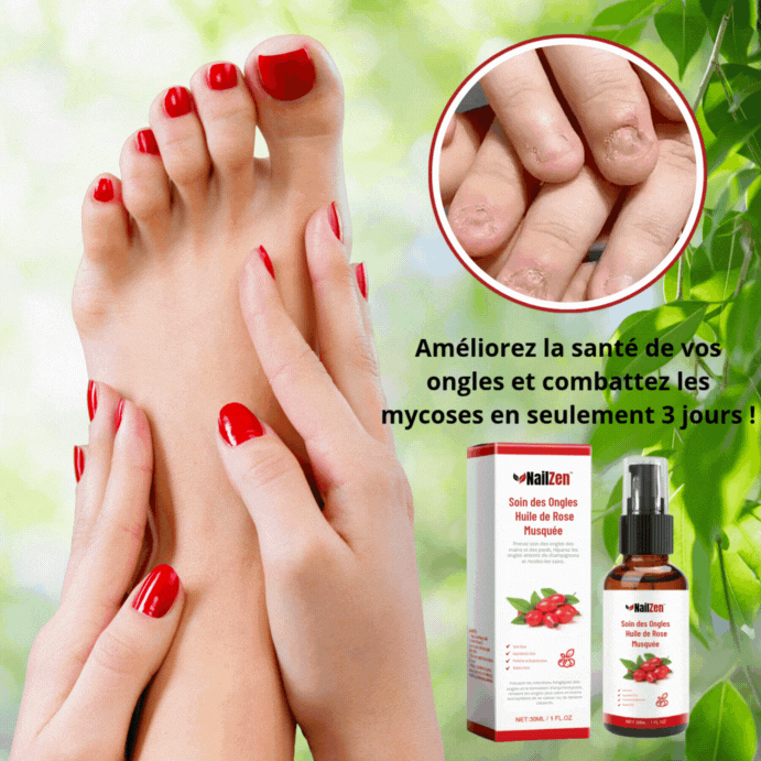 NailZen™ Nagų priežiūra su rožių aliejumi | Pagerinkite savo nagų sveikatą ir kovokite su grybelinėmis ligomis vos per 3 dienas!
