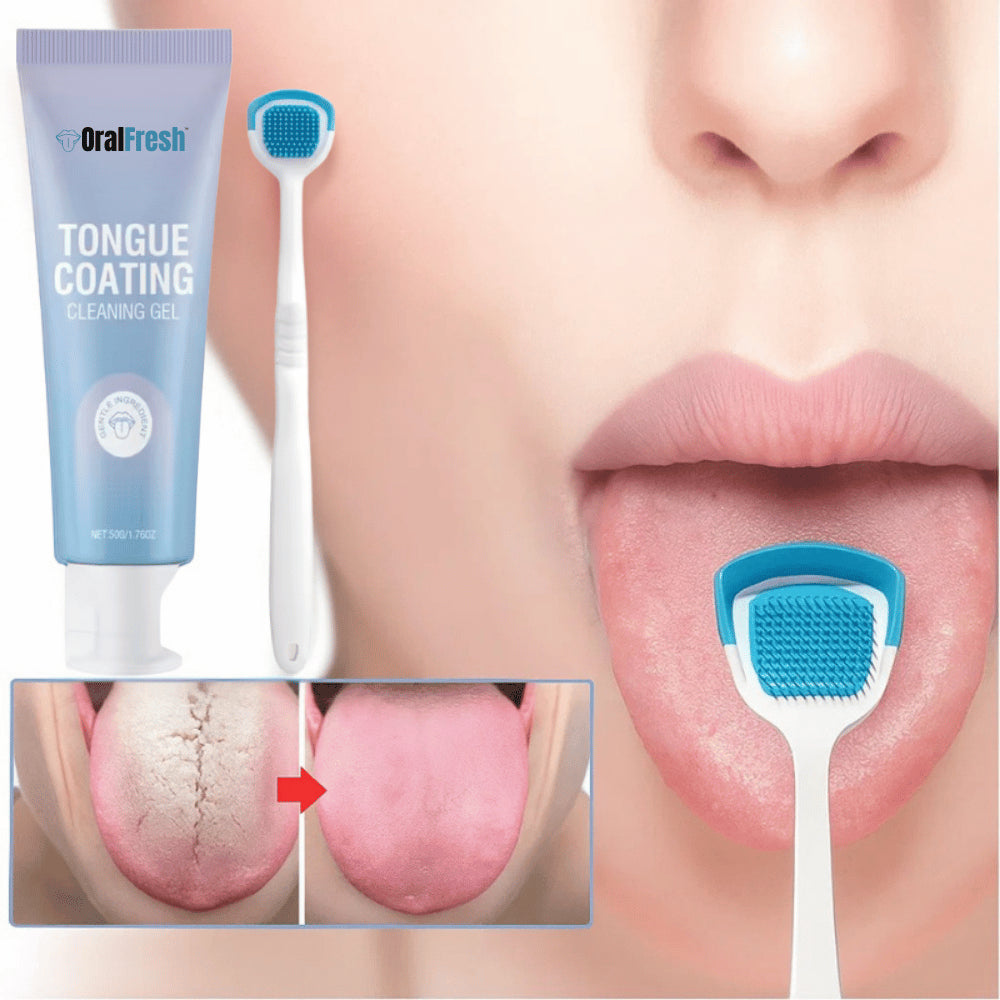 OralFresh™ liežuvio apnašų valymo gelis | Pašalina 97 % blogo kvapo vos per 60 sekundžių!