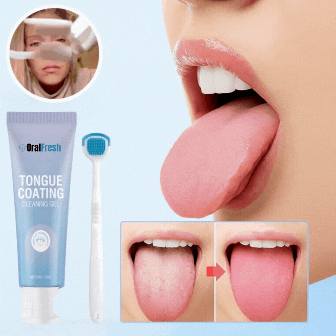 OralFresh™ liežuvio apnašų valymo gelis | Pašalina 97 % blogo kvapo vos per 60 sekundžių!