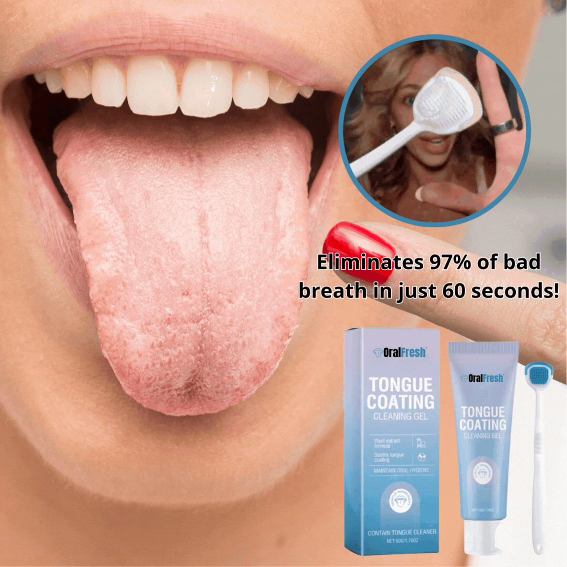 OralFresh™ liežuvio apnašų valymo gelis | Pašalina 97 % blogo kvapo vos per 60 sekundžių!